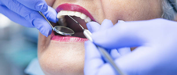 Best Emergency Denture Repair in Suncoast Estates, FL